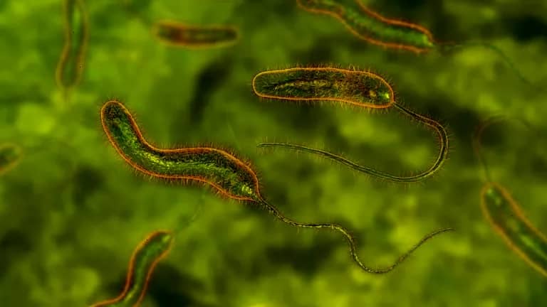 Health: Cholera outbreak in Tarkwa Nsuaem claims three lives